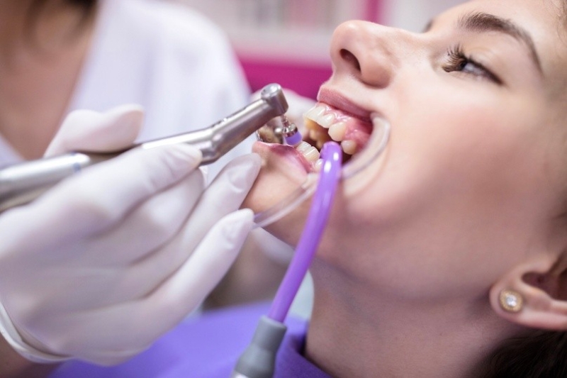 Bild3 Nahaufnahme einer zahnärztlichen Behandlung mit Absaugschlauch und Poliergerät