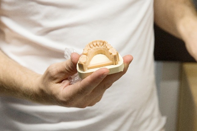 Zahntechnisches Modell eines Oberkiefers